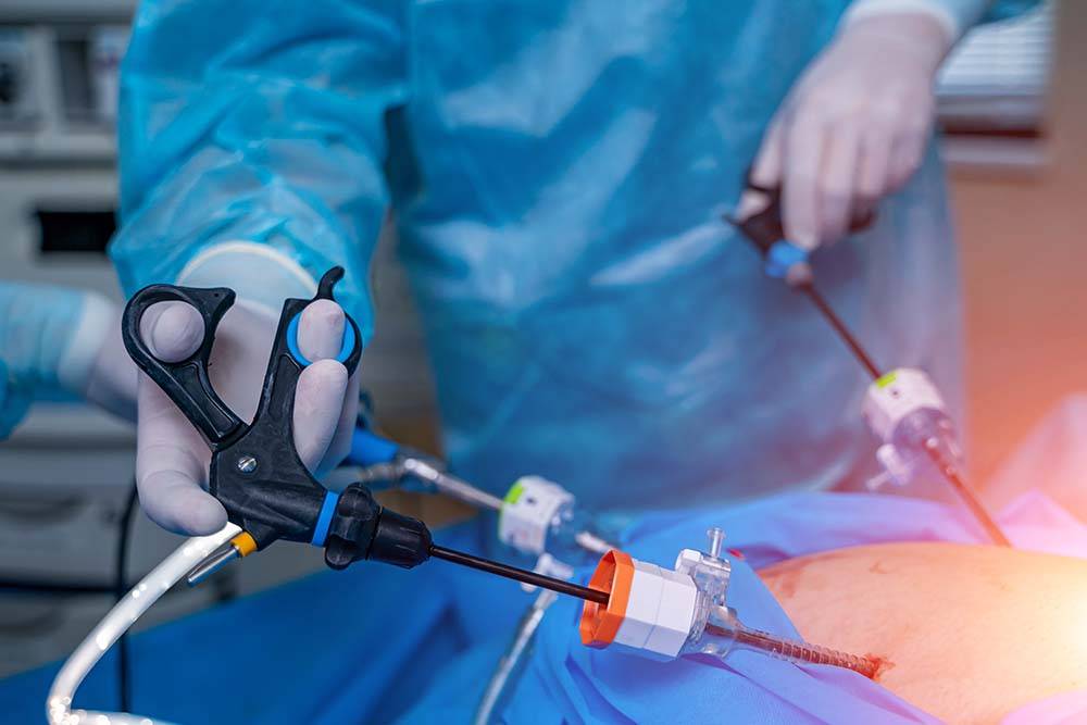 Laparoscopic surgery in Kandivali