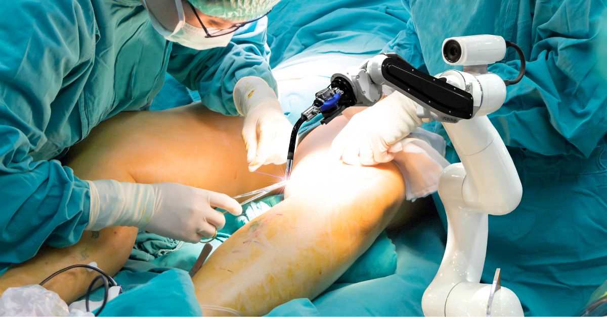 Best Robotic Hip Replacement Surgeon Chandigarh