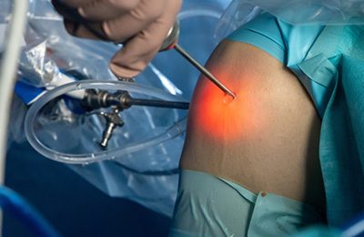 Arthroscopy Surgeon Goa: Specialized Treatment for Joint Conditions