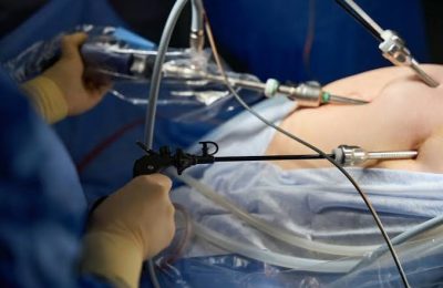 Laparoscopic Surgery in Mumbai – Innovative Minimally Invasive Surgery at Punit Hospital