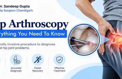 Hip Arthroscopy Chandigarh: Everything You Need To Know