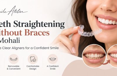 Teeth Straightening Without Braces in Mohali: Explore Clear Aligners for a Confident Smile