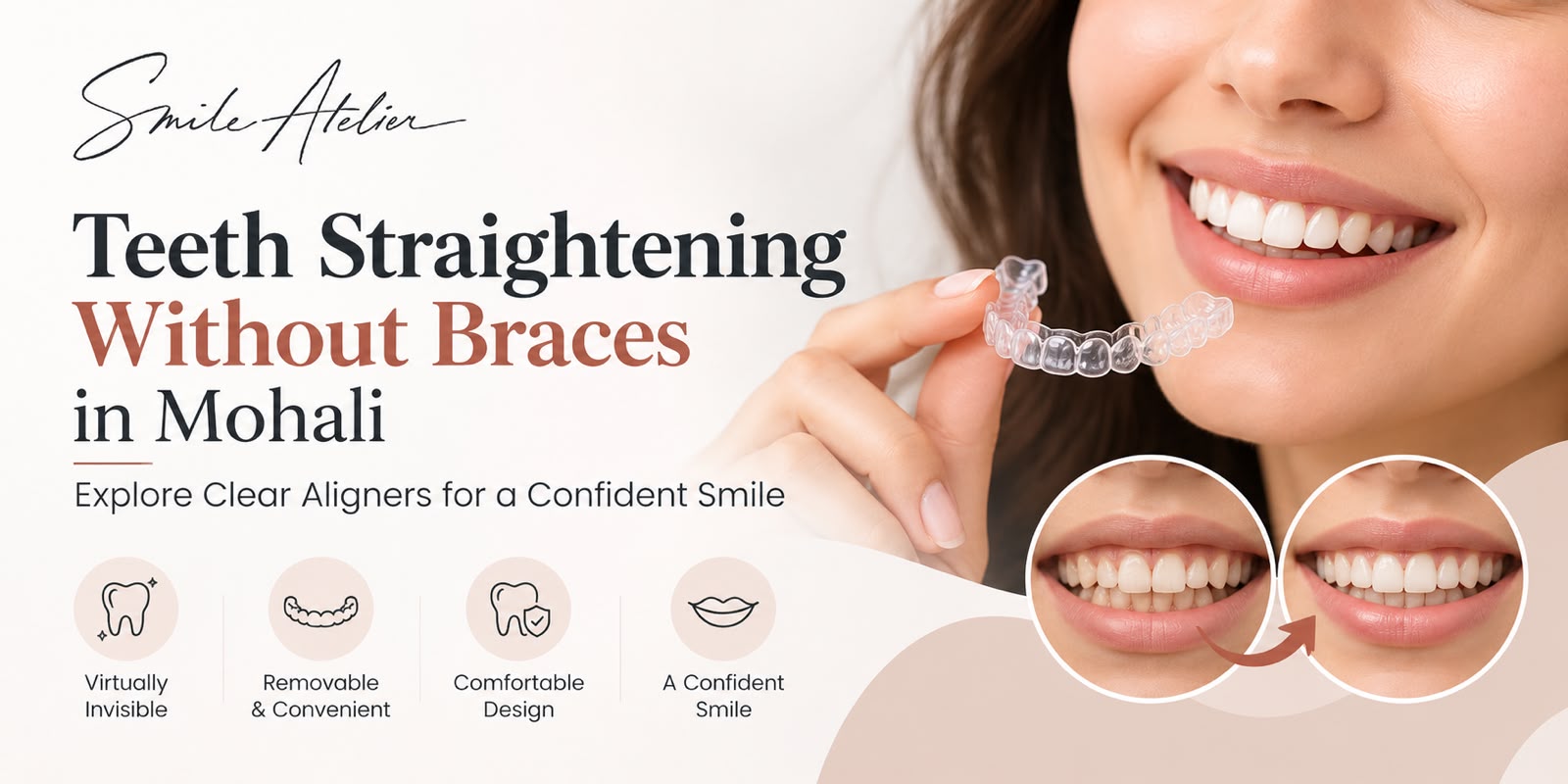 teeth straightened without braces Mohali